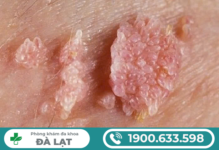 Hình ảnh minh họa